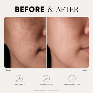 Dark Spot Corrector