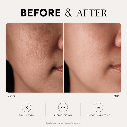 Dark Spot Corrector - LYOVA