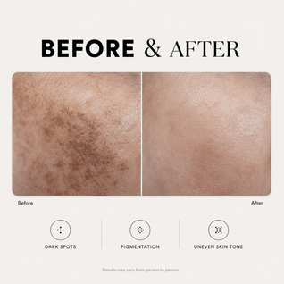 Dark Spot Corrector