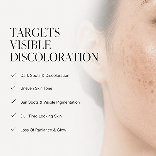 Dark Spot Corrector - LYOVA