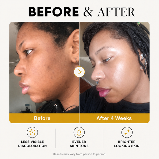 Kojic Acid Turmeric Wrapping Mask