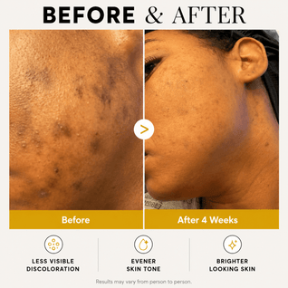 Kojic Acid Turmeric Wrapping Mask