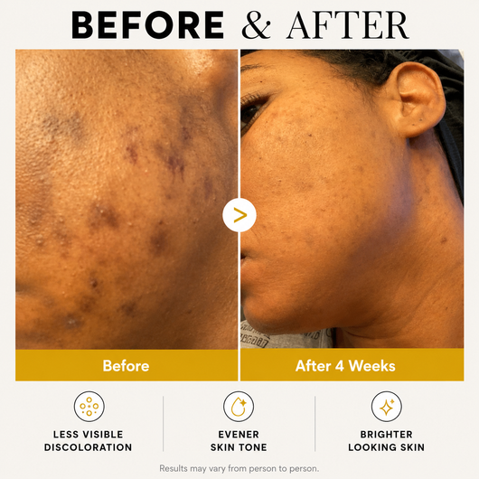 Kojic Acid Turmeric Wrapping Mask